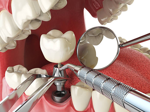Best Emergency Dentist for Special Needs Patients in North Baltimore, OH